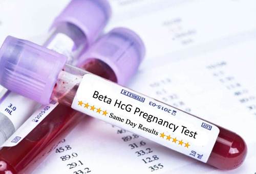 Xét nghiệm máu cho kết quả mang thai nhanh và chính xác